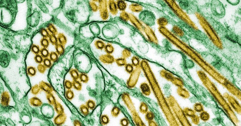 CDC Confirms First US Case of Severe Bird Flu