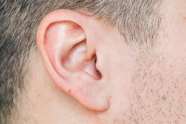 Humans Lost the Ability to Swivel Their Ears—But These Vestigial Muscles Still Twitch