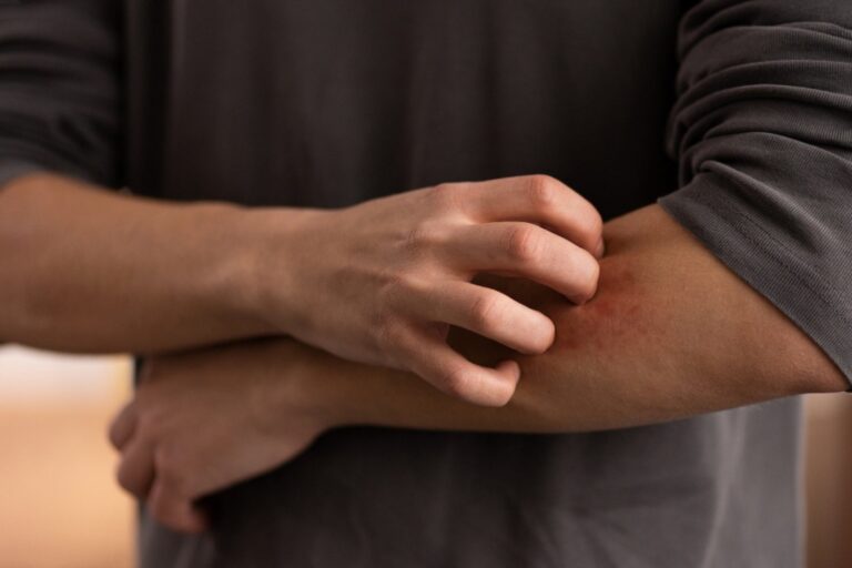 Should You Scratch That Itch? Science Has a Surprising Answer